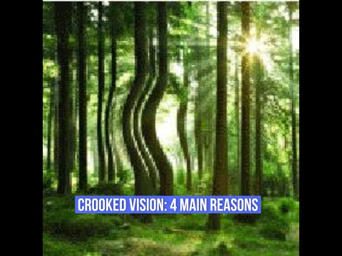 Do you have METAMORPHOPSIA? 4 reasons for DISTORTED VISION #distortion #maculardegeneration