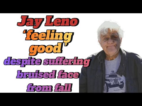 Jay Leno ‘feeling good’ despite suffering bruised face from fall