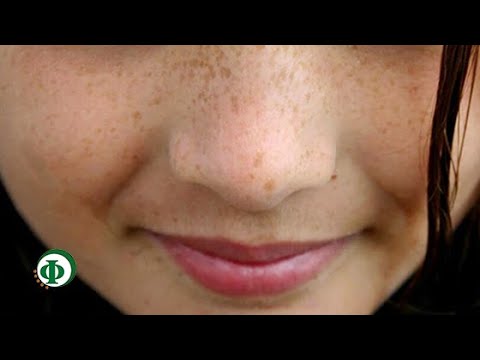 Отбеливающий крем для интимных зон isme whitening leg therapy cream Куркума для кожи лица от пигментных пятен