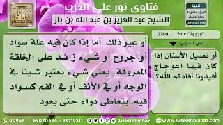 2780 - حكم عمليات التجميل - نور على الدرب image