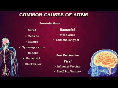 What is Acute Disseminated Encephalomyelitis (ADEM)