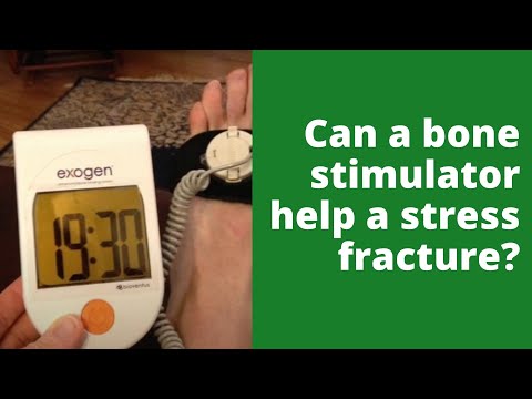 Can a bone stimulator help a stress fracture?