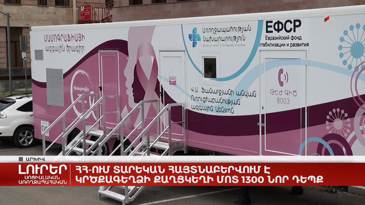 ՀՀ-ում տարեկան հայտնաբերվում է կրծքագեղձի քաղցկեղի մոտ 1300 նոր դեպք