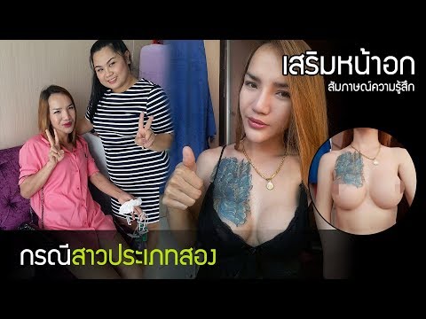 ผลกระทบหลังจากการเสริมเต้านม หน้าอกขนาดใหญ่ที่มีเพิ่มขึ้นเล็กน้อยใน