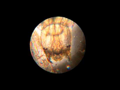 Microscope view of larvae head
