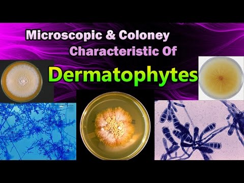 Kung paano mapupuksa ang halamang-singaw sa kuko iodine Isang lunas para sa allergies fungus