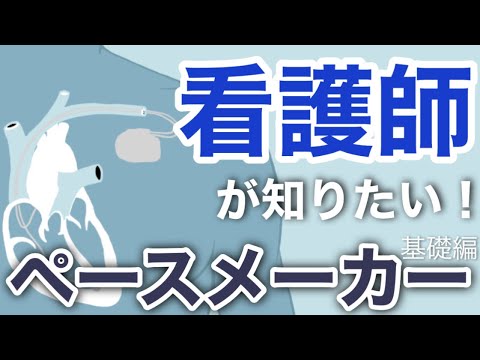ペースメーカーについて詳しく解説