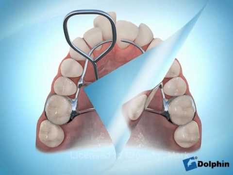 Conseil vidéo orthodontie