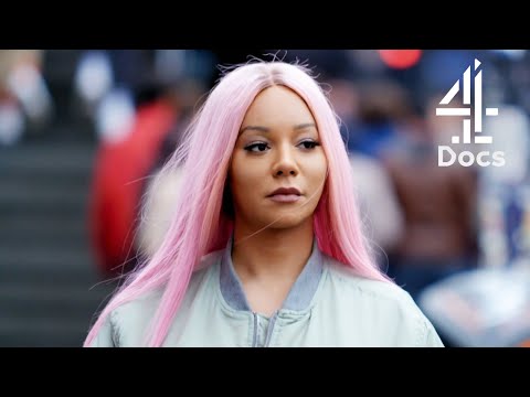 Transgender Model Undergoes Facial Surgery to Match Her Femininity