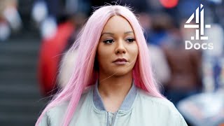 Transgender Model Undergoes Facial Surgery to Match Her Femininity