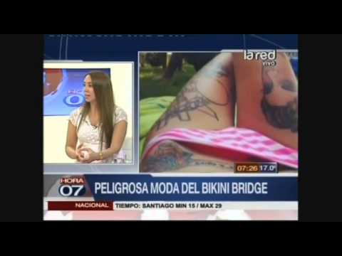Bikini Bridge: Peligrosa moda del verano