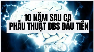 Livestream rút gọn: 10 năm DBS – Hành trình & câu chuyện từ ca phẫu thuật đầu tiên