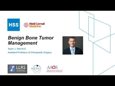 Benign Bone Tumor Management