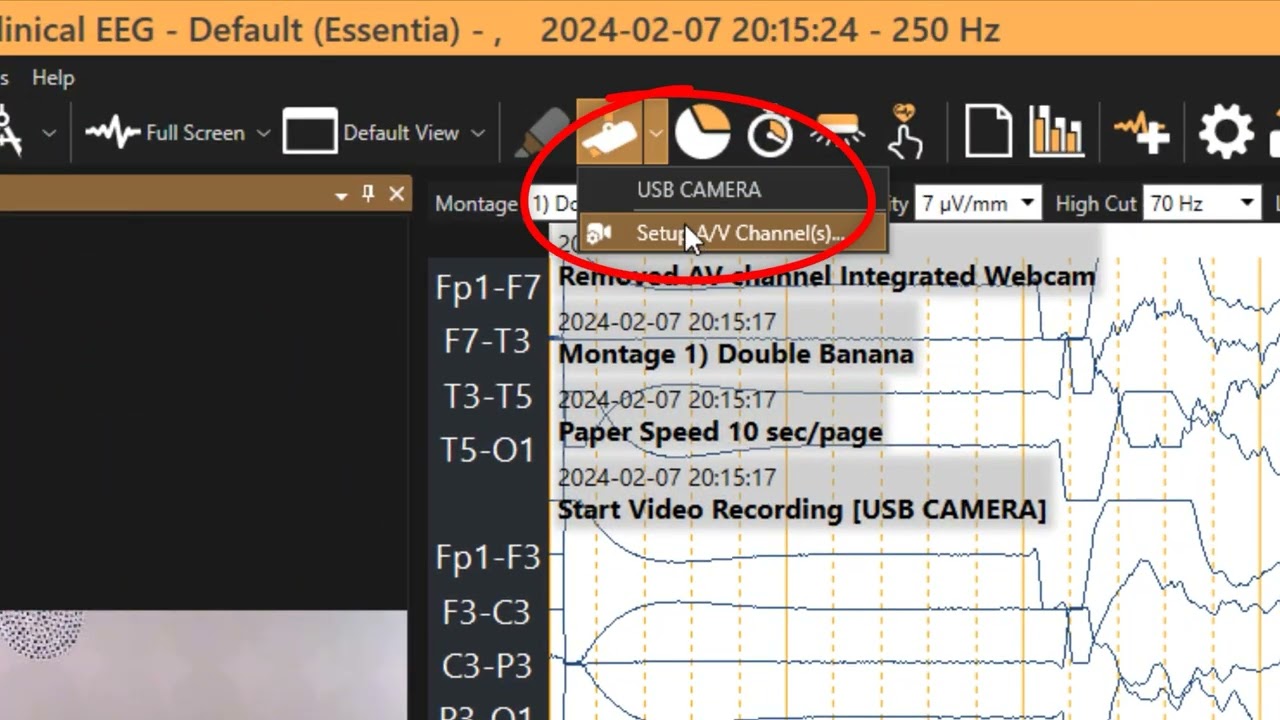 Arc 3.2 Multi-Camera Setup | Step 4: Multi-Camera Video Recording