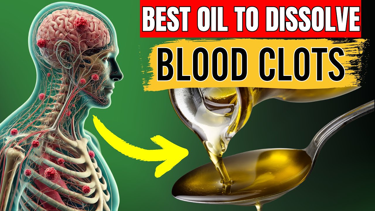 Melt Blood Clots Naturally: Top 15 Powerful Oils (Doctors Never Say THIS)