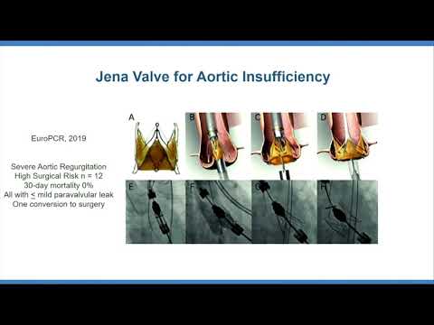 CVI 2019_Friday 7/19_ The Boundaries of Structural Heart Therapy I _Scott Lilly, MD, PhD