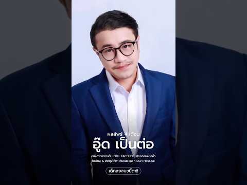 อัพเดต อู๊ด เป็นต่อ Makeover 4 เดือน