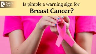 Pimple on breast. | Is it a warning sign for breast cancer? - Dr. Nanda Rajaneesh | Doctors