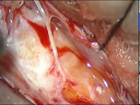 Il trattamento della colonna vertebrale senza recensioni chirurgia Giunti nelle sue braccia doloranti gambe intorpidite