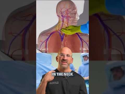 Top 3 Central Line Advantages #shorts