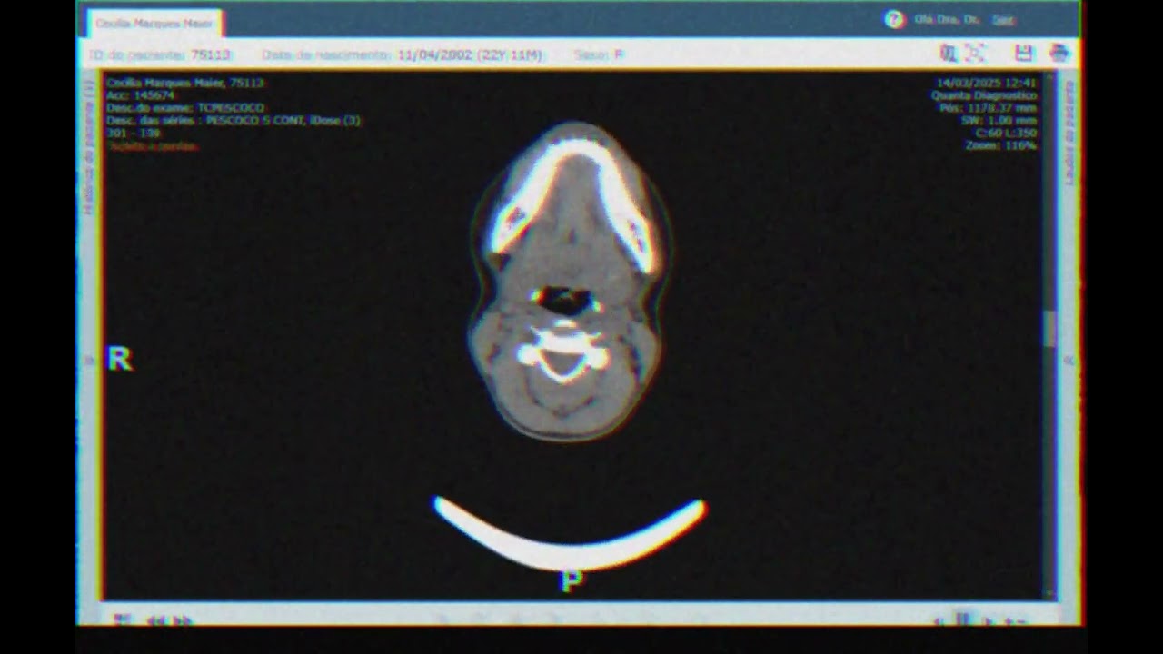 Uma tomografia do meu pescoço (2025)