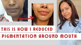 This is How I removed pigmentation around mouth | Get rid of even dullness