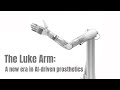 The Luke Arm: A new era in AI-driven prosthetics
