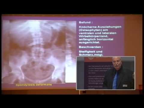 Röntgenstrahlen der Gelenke in Vladimir Schmerzen im unteren Rücken während der Schwangerschaft t