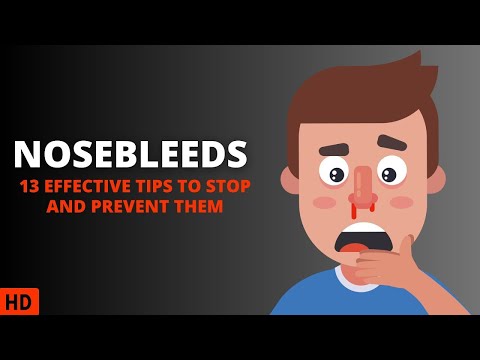 Nosebleed 101: What You Need to Know