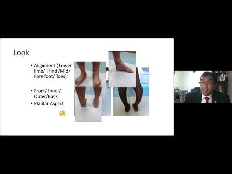 Clinical examination of the foot and ankle for FRCS
