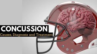 CONCUSSION, Causes, Signs and Symptoms, Diagnosis and Treatment.