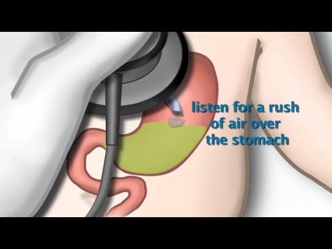Nasogastric Tube Placement by S. Hamilton | OPENPediatrics