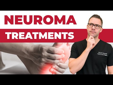 Gout Attack in the Big Toe Joint Foot Diet Treatment 2 MINUTES