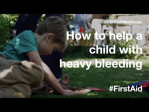 How to help a child with heavy bleeding #FirstAid #PowerOfKindness