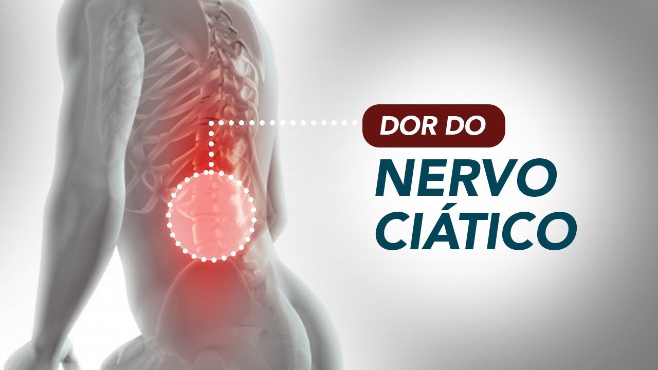 Nervo ciatico - O que é e o que pode afetá-lo