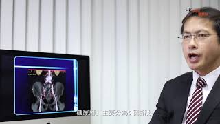 無需截肢 ---「糖尿腳」末期有得醫