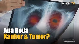 Download lagu Inilah Perbedaan Kanker dan Tumor | Kontan News mp3