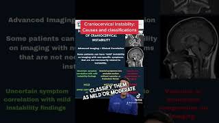 Craniocervical Instability: Causes and classifications