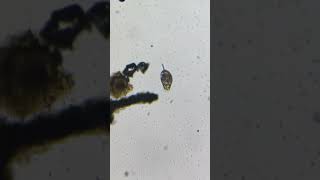 Microorganism under a microscope #smallyoutuber #biology #science #shorts #animal
