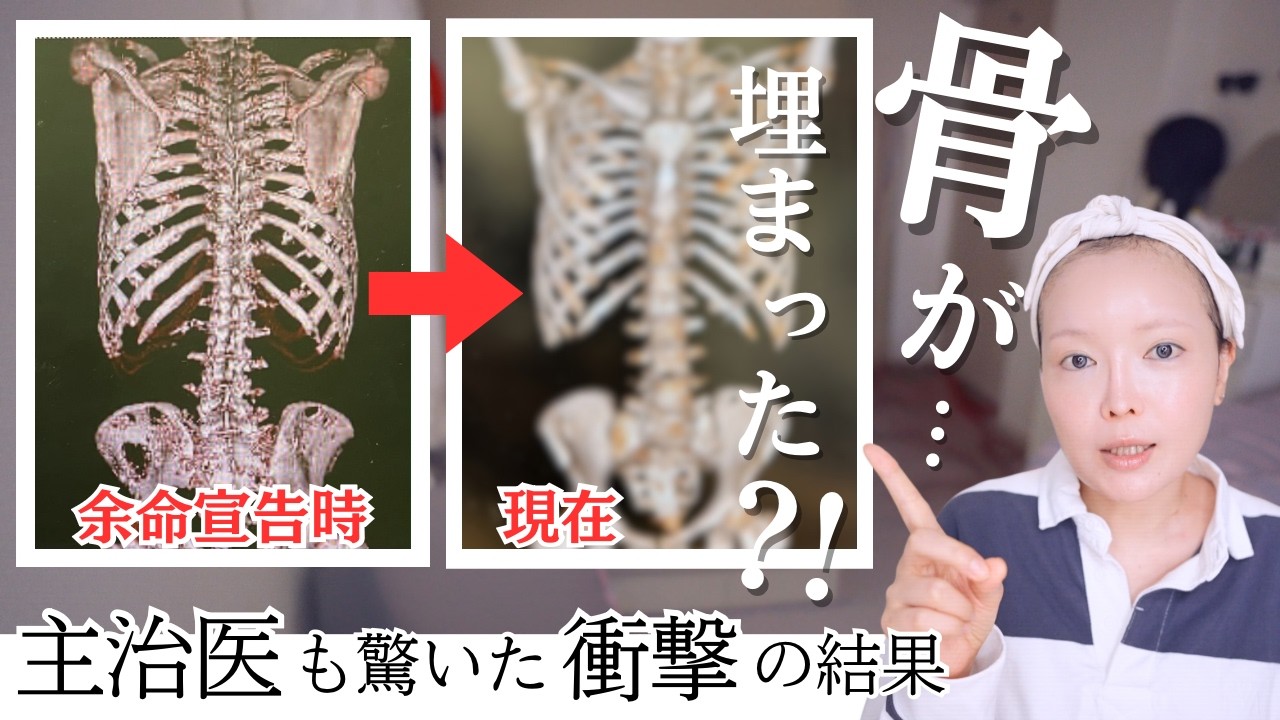 【現状報告】2週間の寝込み生活。でもヘモグロビン爆上がり！主治医も驚いた骨の変化！