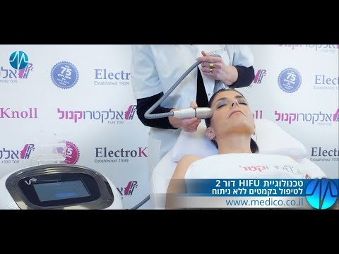 טכנולוגיית HIFU דור 2 לטיפול בקמטים ללא ניתוח