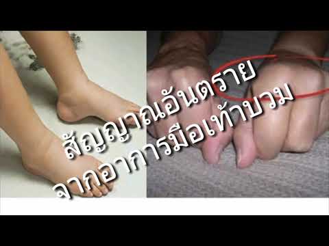 โรคสะเก็ดเงินยาสูบ การออกกำลังกายสำหรับโรคสะเก็ดเงิน