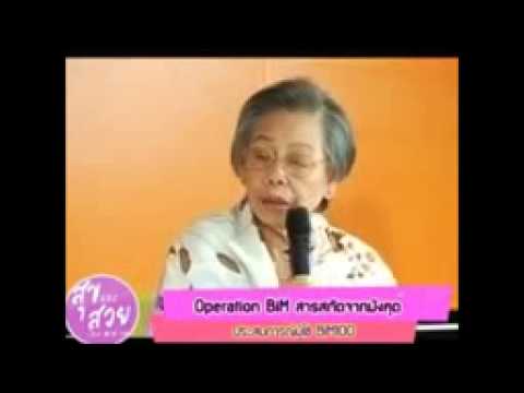 การรักษาความอ่อนแอ ASD-2F แรงนานเสร็จสิ้น