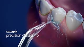 Waterpik Precision Tip