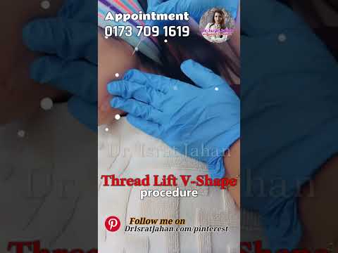 V-Shape Face with Thread Lift - Dr. Israt Jahan