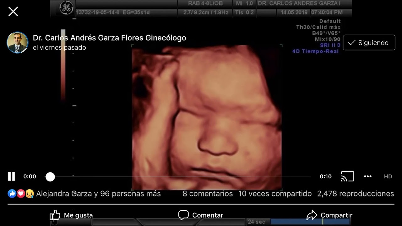 Carlos Andrés Garza Flores-17