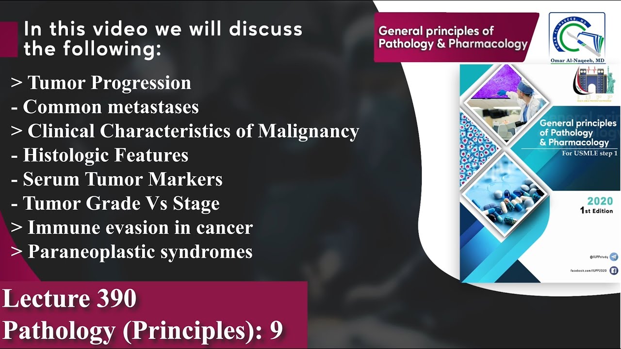 Tumor Progression | Clinical Characteristics of Malignancy | Paraneoplastic syndromes