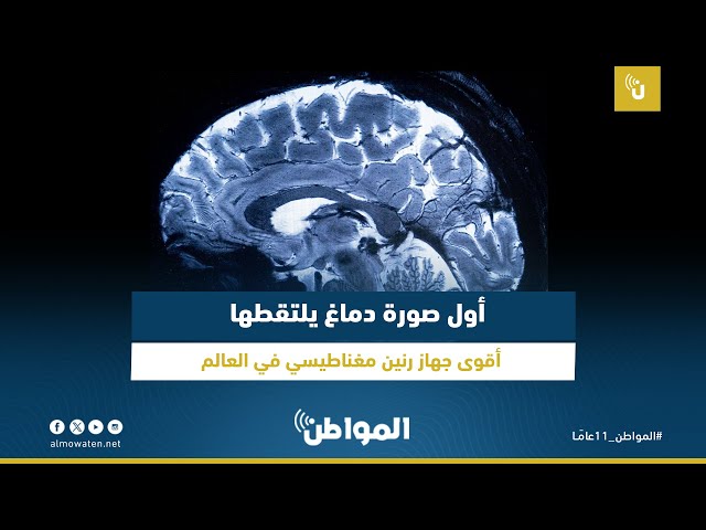 أول صورة للدماغ يلتقطها أقوى جهاز رنين مغناطيسي في العالم