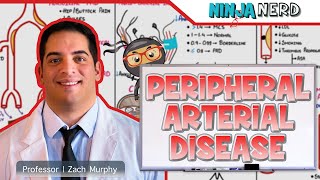 Peripheral Arterial Disease | Clinical Medicine