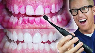 🦷 Dentist’s DAILY TOOTH CARE ROUTINE: Brush & Floss Your Teeth PROPERLY! Techniques to Stop Cavities